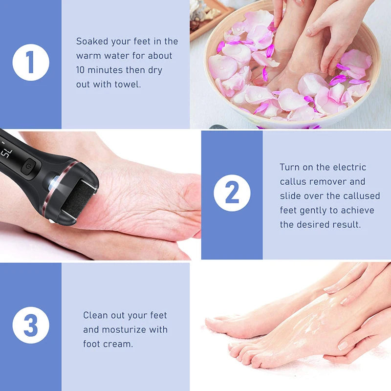 Electric Foot Callus Remover | 18-in-1 Pedicure Kit with 3 Roller Heads